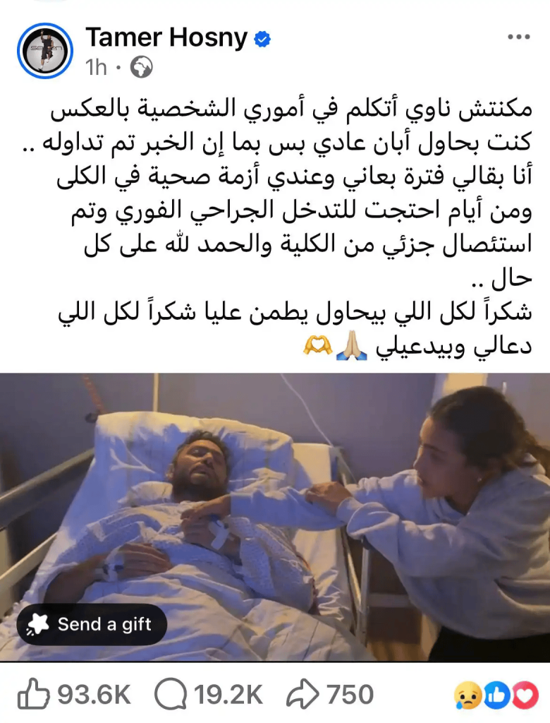 استئصال جزء من كلية تامر حسني