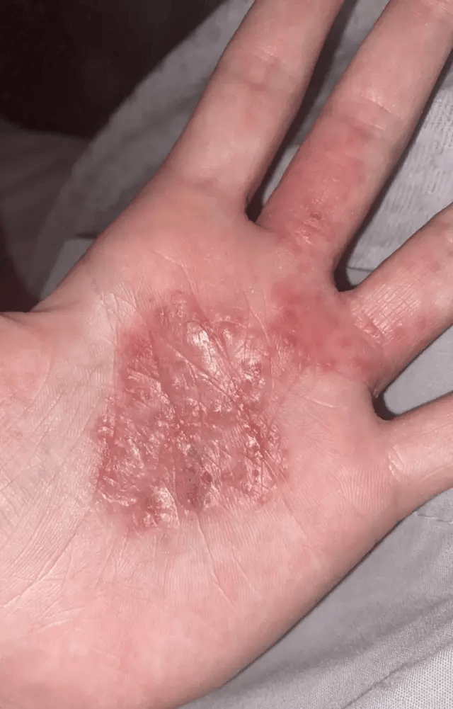  دارسي هاميلتون