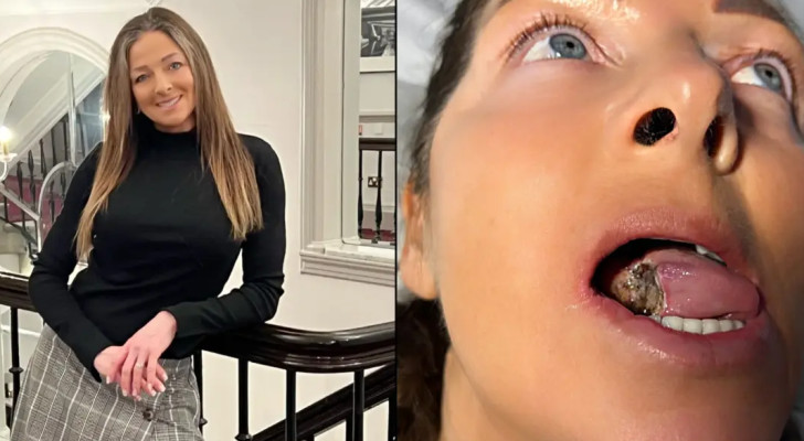 سيدة تحكي معاناتها مع الأطباء: أزالوا نصف لسانها بعد تشخيص خاطئ!