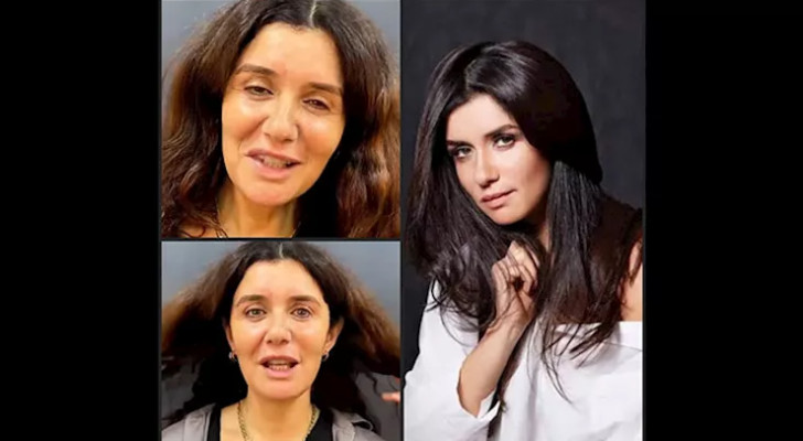 غادة عادل تكشف بصراحة: خضعت لعملية شد وجه ولا أشعر بالحرج!