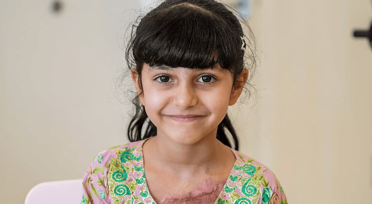 طفلة إماراتية تنجو من "تحدي الدمى الشريرة" بعد احتراق فستانها