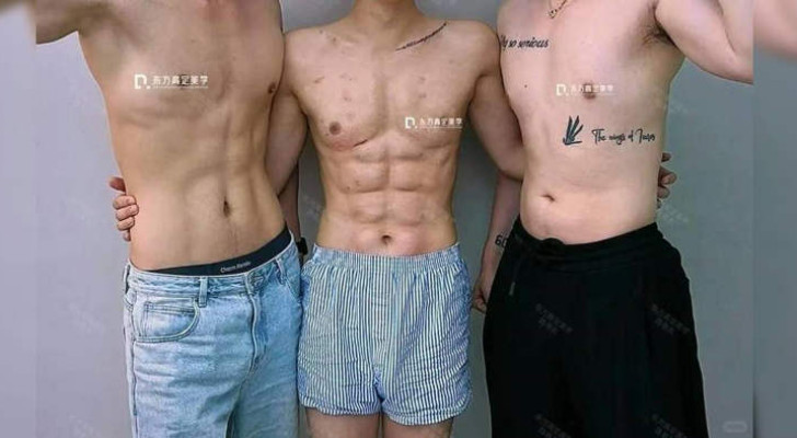 صانع محتوى صيني ينفق أكثر من نصف مليون دولار ليصنع عضلات بطن مزيفة ويتحدى متابعيه!