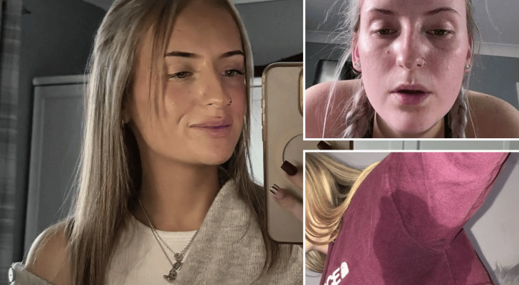 هذه الشابة تعاني من مرض نادر يجعلها تفرز 3 لتر من العرق يوميا!