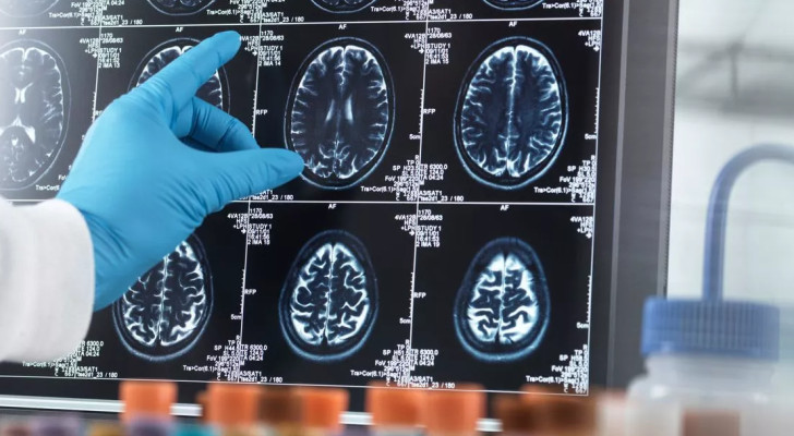 "تجنبها فورا!".. أطعمة يدعي الأطباء أنها ستدمر دماغك!