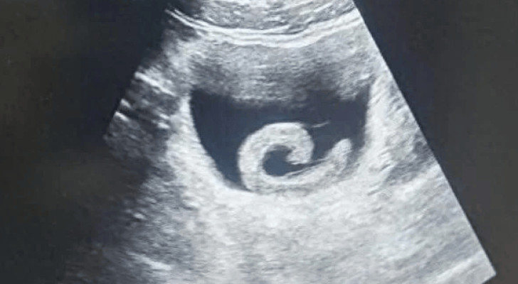 صيني يدخل دودة حية إلى جسده عبر المثانة بسبب وصفة شعبية قرأها على الإنترنت!