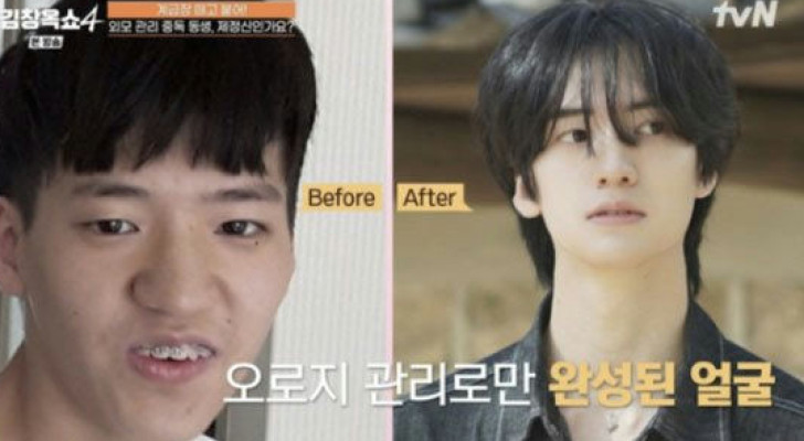 "لم أخضع لعملية تجميل".. شاب كوري يرجع التغير الجذري في شكله لتغيير نمط حياته!