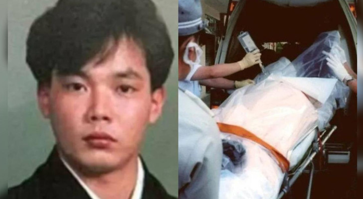 قصة “الرجل المشع” في اليابان.. 83 يوما من المعاناة وعضو واحد فقط سليم!