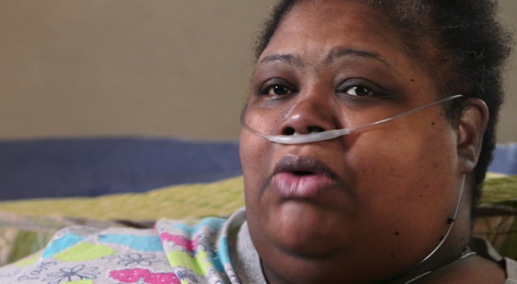 بعد أن بلغ وزنها 363 كيلوجراما.. أمريكية تستعيد قدرتها على الوقوف بعد عامين في الفراش!