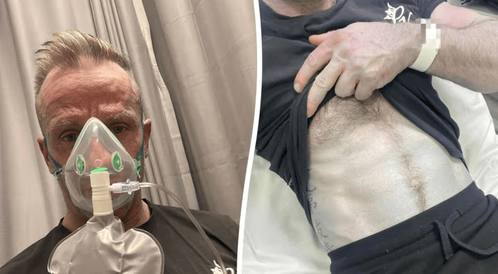 رجل يستيقظ بجلد أزرق مثل شخصية أفاتار ويكتشف السبب المضحك بعد ذهابه للطوارئ!