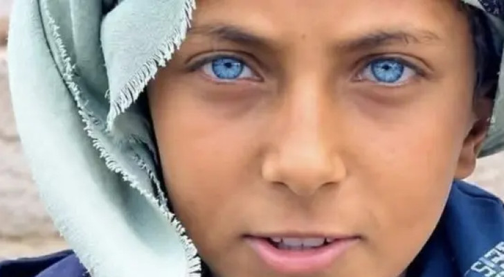 طفل يمني يثير تفاعلا واسعا بسبب لون عينيه